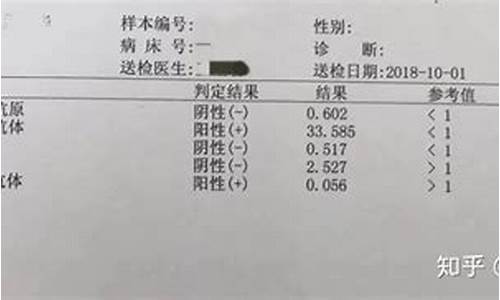 高考体检能查出乙肝吗,高考体检能检查乙肝吗